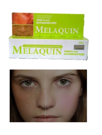 What is melaquin